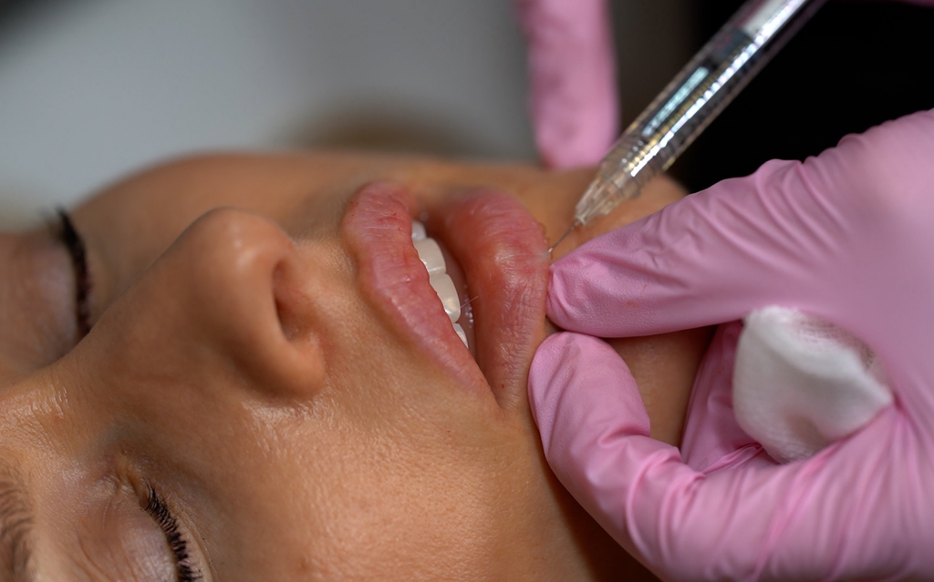 dermal fillers