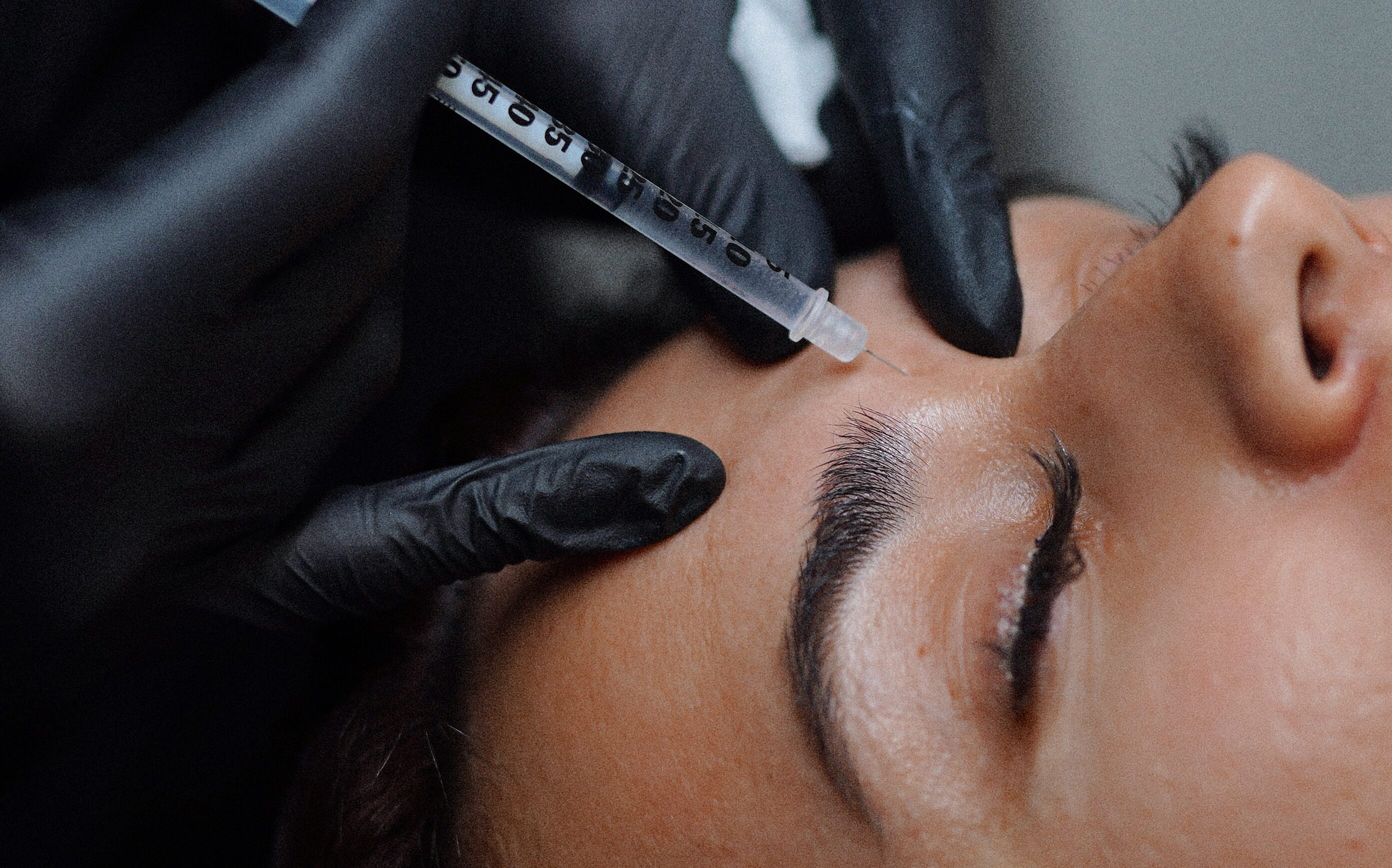 Anti-Wrinkle Injections